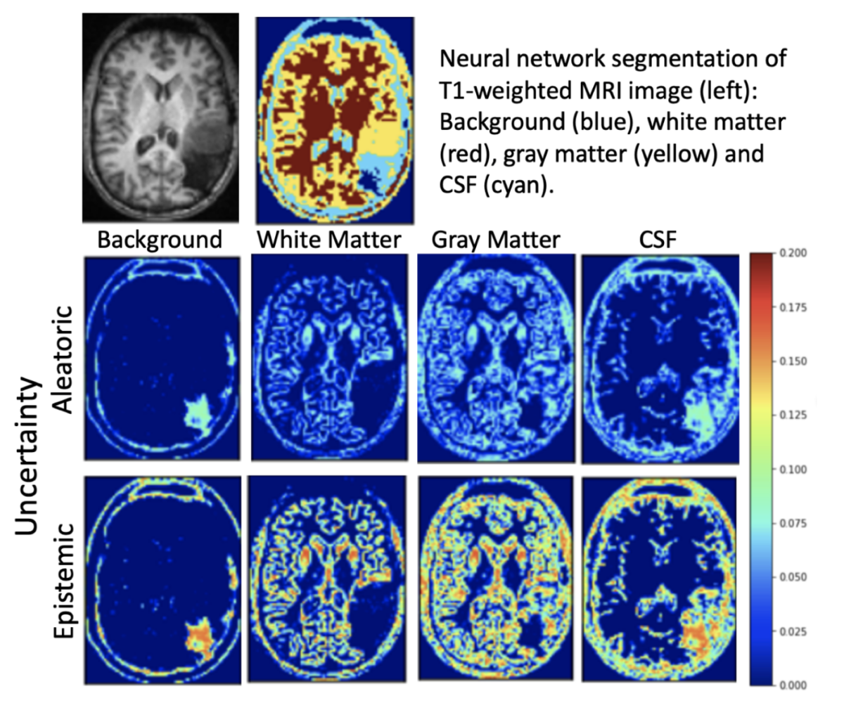 quantifying-uncertainty-in-neural-network-segmentation-rail